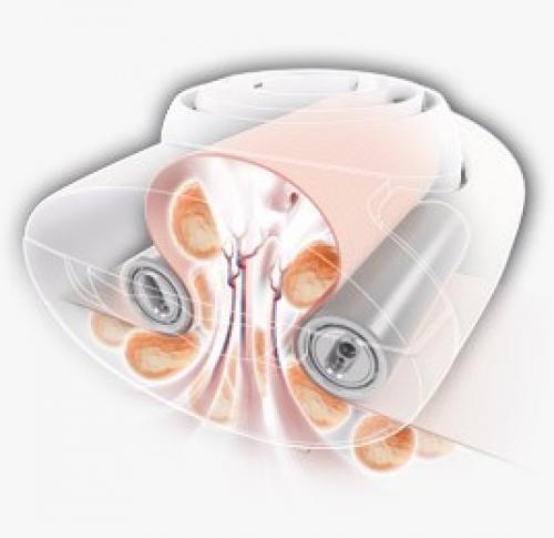 Эффект от LPG массажа. Для кого подойдёт LPG массаж 01