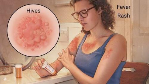 Почему отекают руки от локтя до кисти или плеча: основные причины и решения 01