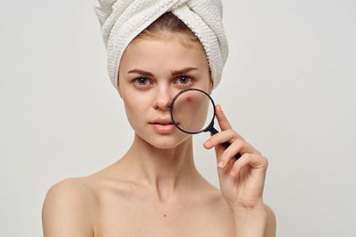 Как избавиться от отеков на лице после алкоголя. Отказ от спиртного: результат на лицо