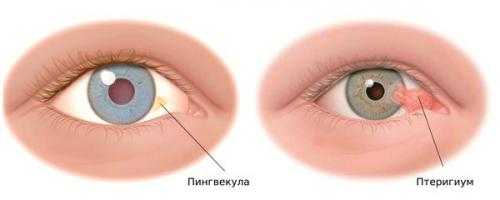 Если веки глаз чешутся. Почему чешутся глаза? 09 Если веки глаз чешутся. Почему чешутся глаза? 09