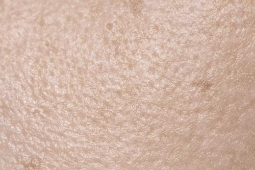 Как я убрала морщины под глазами. Особенности строения кожи