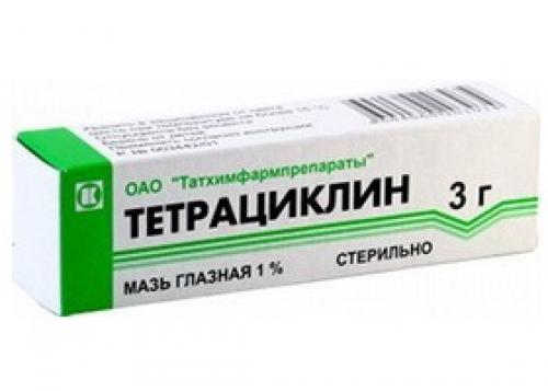 Воспаление на нижнем веке, как лечить. Лечение блефарита