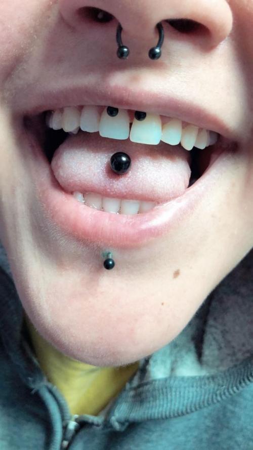 Какой катетер нужен для прокола септума. Лучший вариант для прокола детский ушек 29