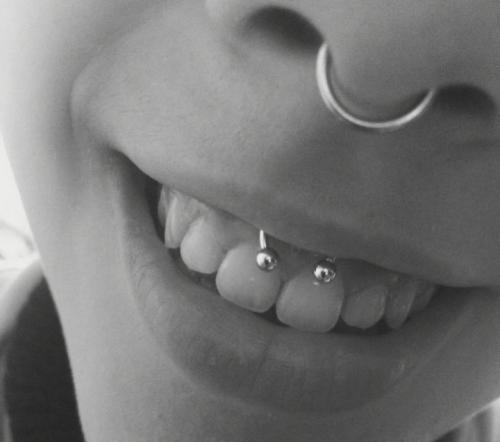 Какой катетер нужен для прокола септума. Лучший вариант для прокола детский ушек 24