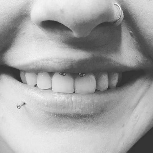 Какой катетер нужен для прокола септума. Лучший вариант для прокола детский ушек 23