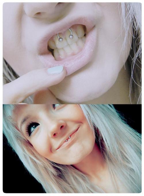 Какой катетер нужен для прокола септума. Лучший вариант для прокола детский ушек 18