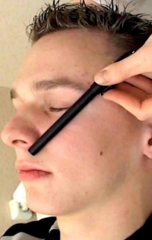 Какой катетер нужен для прокола септума. Лучший вариант для прокола детский ушек 02