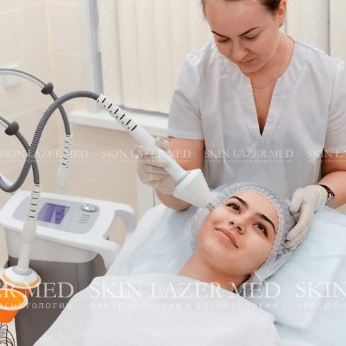 RF-лифтинг лица до и после. РФ лифтинг лица