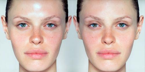 Плюсы жирной кожи. Как ухаживать за кожей в зависимости от ее типа? 02 Плюсы жирной кожи. Как ухаживать за кожей в зависимости от ее типа? 02