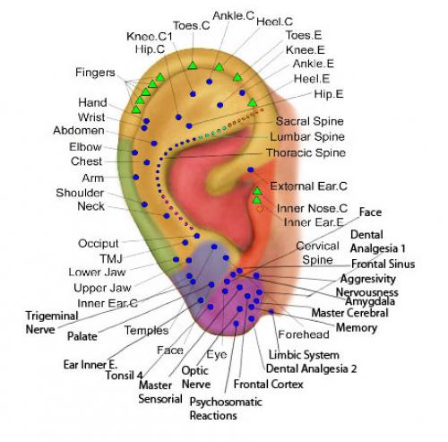 Прокол ушной раковины. Коррекция мочки уха 02 Прокол ушной раковины. Коррекция мочки уха 02