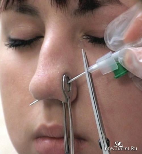 Прокол крыла носа кому идет. Пирсинг носа: что нужно знать?