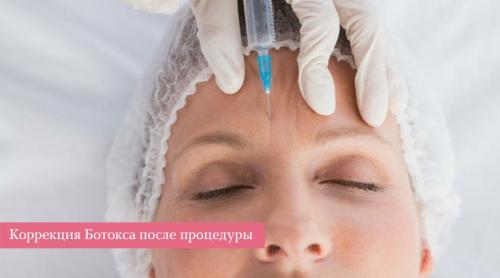 Через сколько встает ботокс после процедуры. Плюсы и минусы применения в косметологии 14 Через сколько встает ботокс после процедуры. Плюсы и минусы применения в косметологии 14