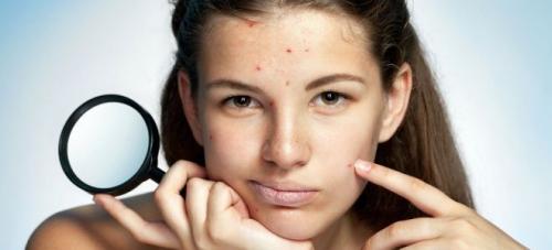 Виды прыщей на лице и что они означают. О чем говорят прыщи на лице