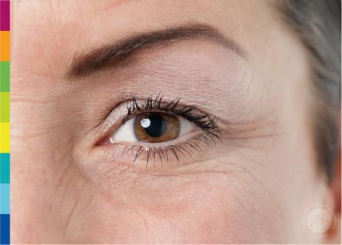 Как УБРАТЬ мимические МОРЩИНЫ вокруг глаз. Все способы избавиться от морщин вокруг глаз 03