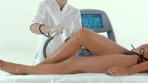 Какая эпиляция самая эффективная?