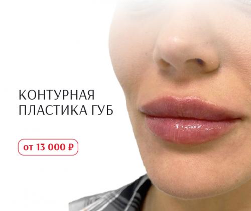 Противодействие комедонам: простые советы для здоровой кожи 04