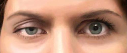 Почему глаза могут слезыться: основные причины и способы устранения 05