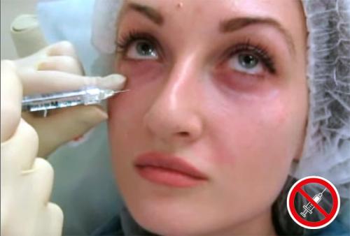 Победите мешки под глазами: проверенные методы устранения утренней волдыри 01