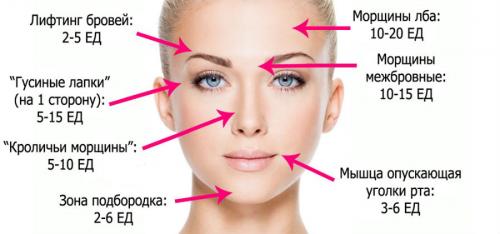 Ботулотоксин в косметологии противопоказания. Ботокс - что это такое и на что способен препарат? 04 Ботулотоксин в косметологии противопоказания. Ботокс - что это такое и на что способен препарат? 04