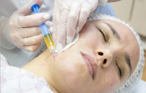 Плазмолифтинг вокруг глаз. Плазмотерапия