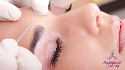 Как убрать глубокую межбровную морщину. Как быстро убрать межбровные морщины у косметолога 02