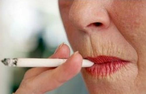 Как убрать кисетные морщины. Как избавиться от кисетных морщин? 02