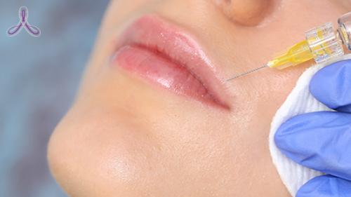 Как убрать морщины вокруг губ. Почему появляются мимические морщины вокруг губ? 01