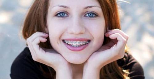 Как убрать морщины вокруг губ. Почему появляются мимические морщины вокруг губ? 04 Как убрать морщины вокруг губ. Почему появляются мимические морщины вокруг губ? 04