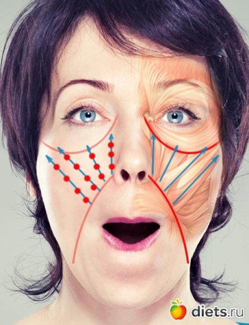 Как избавиться от носогубных складок. Как убрать носогубные складки? 06