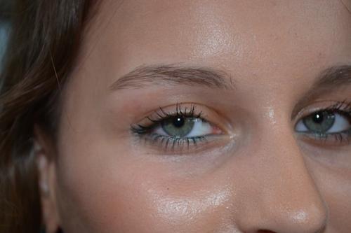 Расширенные поры на лице. Откуда берутся широкие поры на лице 01