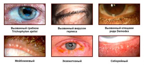 Отек над глазом под бровью. Симптомы блефарита