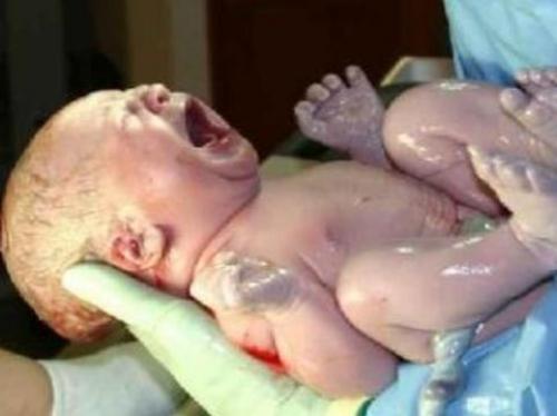 Дети рожденные в 37-38 недель. Родившиеся за несколько недель до срока дети болеют чаще сильно недоношенных